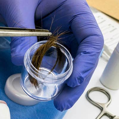 Hair analysis to Identify the Detoxification Process. Hair analysis to Identify the Detoxification Process.