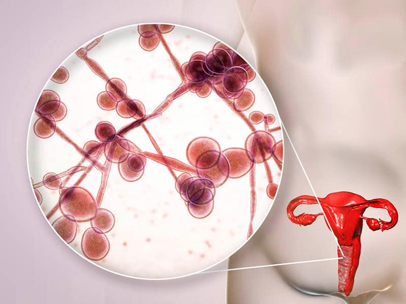 Candida Growth Candida Growth